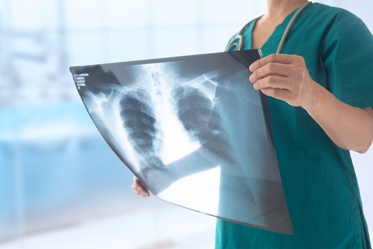 X-rays